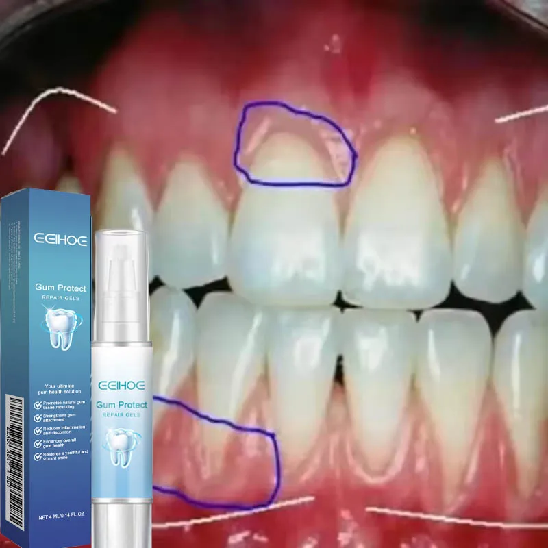 Teeth Whitening Product Gum Repair Drops Damaged Gum Repair Care Gel Teeth Whitening Toothpaste