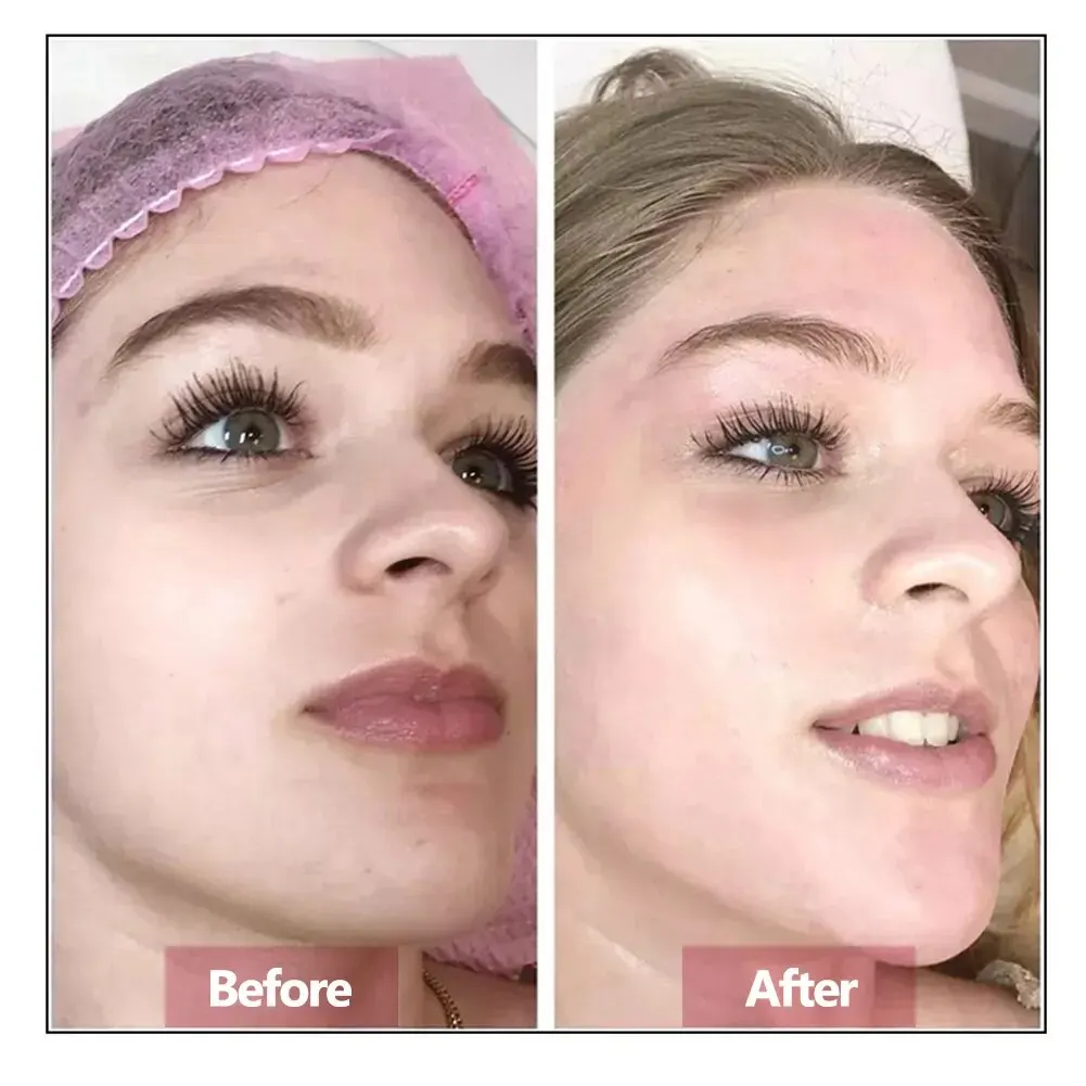 Hyaluronic Acid Face Serum Essence Skin Repair Rejuvenation Firming Moisturizing Hydrating Anti Aging 3