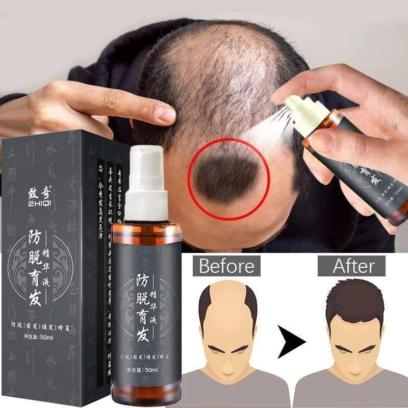 

2022 Fast Hair Growth Serum Hair Tonic For Men &Women Hair Growth Anti Hair Fall Hair Loss Serum Hair Thinning Treatmen