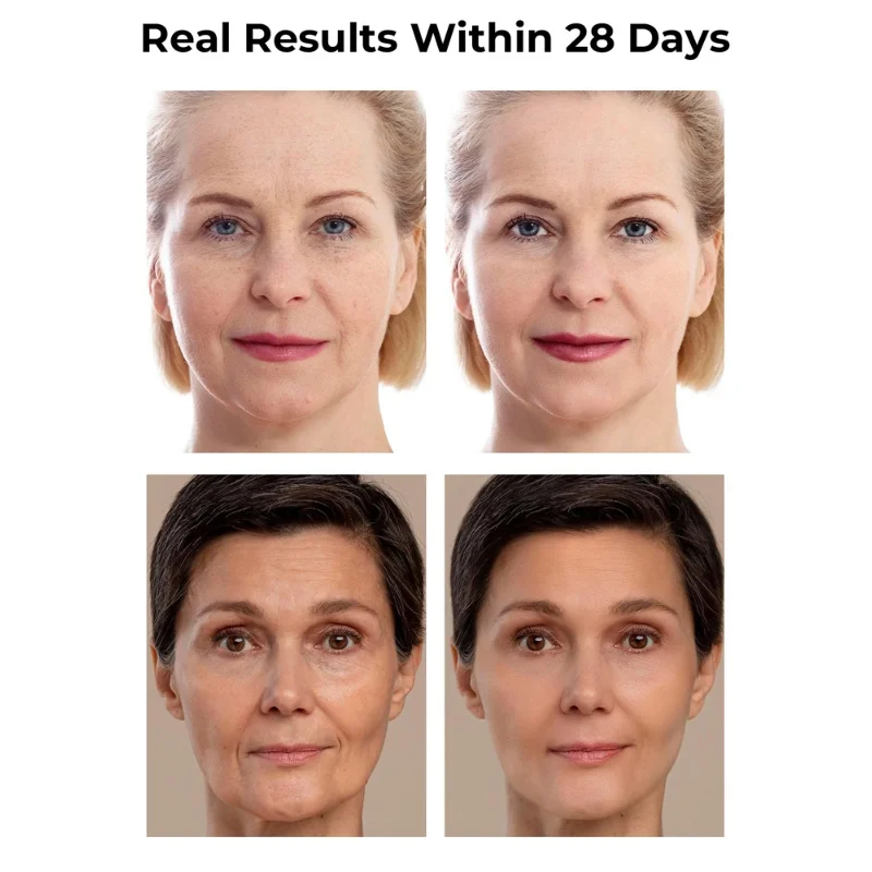 Anti-Wrinkle Facial Serums Reduces Fine Lines and Wrinkles Boosts Collagen  Hydrates and Plumps the Skin Brightens the Skin 2