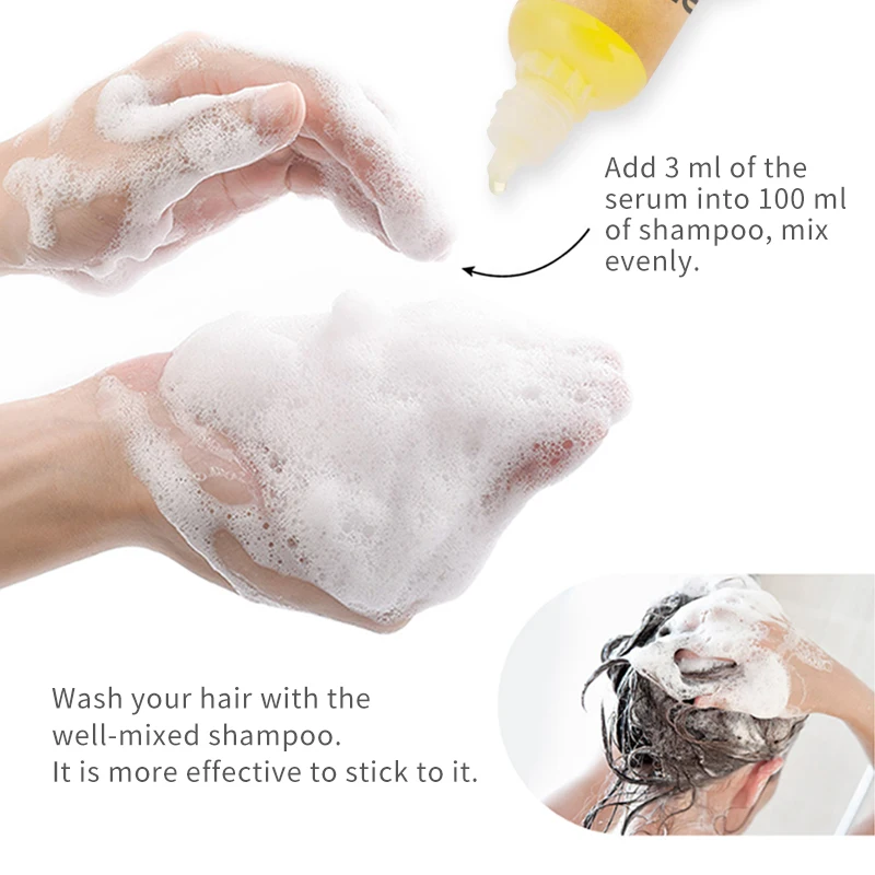 Hair Growth Essence Shampoo Mate 5Pcs Hair Regenerating Oil Reduce Loss Liquid 20ML