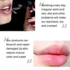 NEW Sumptuous Pure Natural ESSENCE Lip Balm Remove Dark Lighten Lip Mask Fade Lip Line Brighten Exfoliating Moisturize 3