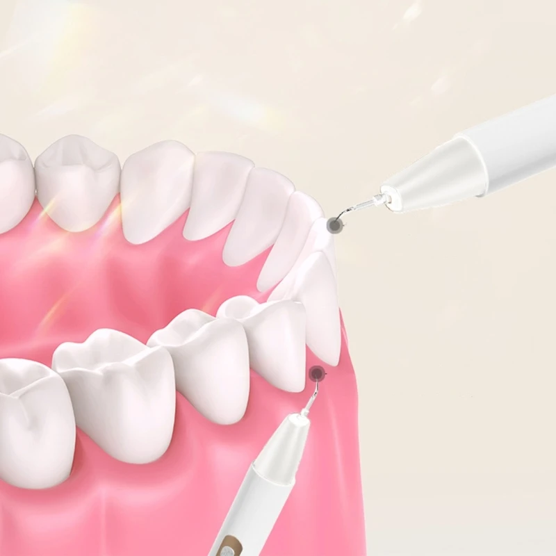 Description Picture 6 of itemDurable Portable Water Flosser Dental Cleaner Orals Irrigator for Effective PlaqueTartar Removal with 5 Adjustable Modes