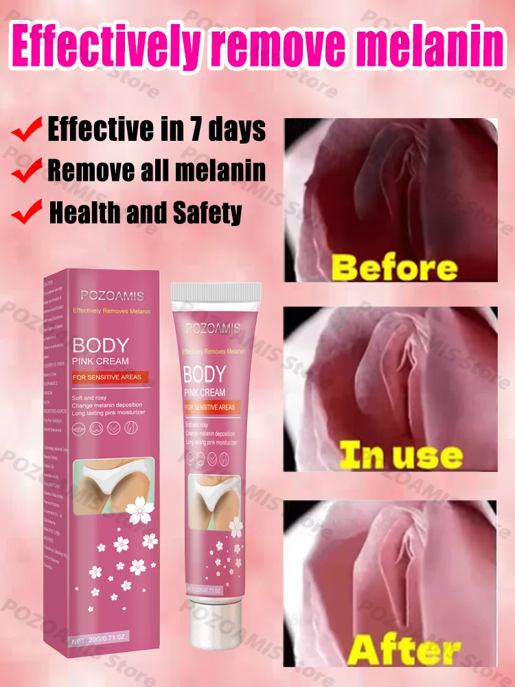 Face whitening cream removes freckles and dark spots lightens pigmentation