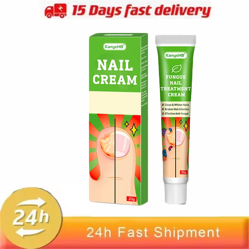 קרם לטיפול בפטרת ציפורניים, רגליים ורגליים, סרום להסרת פטרת ציפורניים, נגד דלקת, אוניכומיקוזיס, פרוניכיה וטיפוח