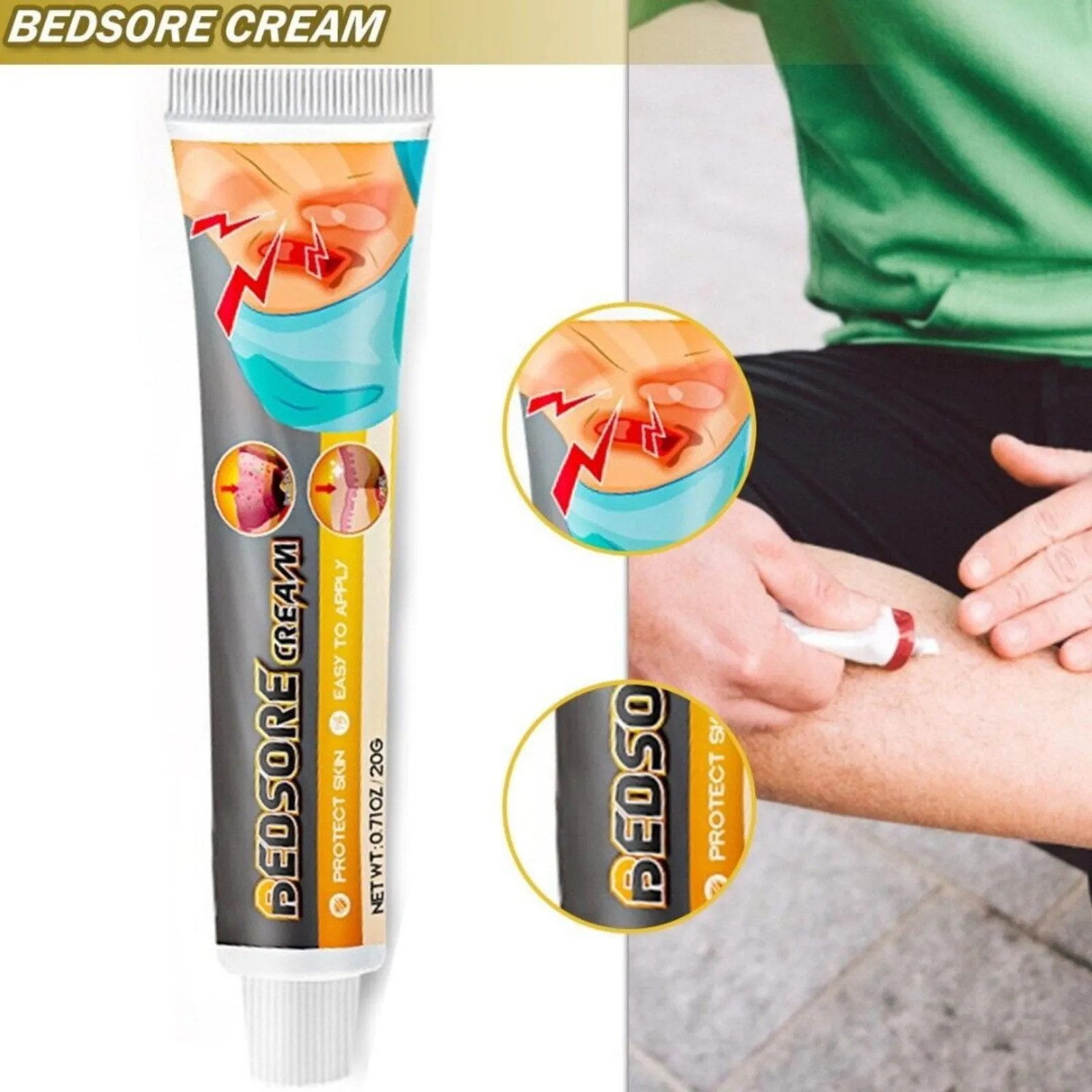 Bedsore Treatment Cream Pressure Sore Ulcer Skin Rot Necrotic Repair Ointment Bed Sore Wound Healing Decubitus Feet Care Gift