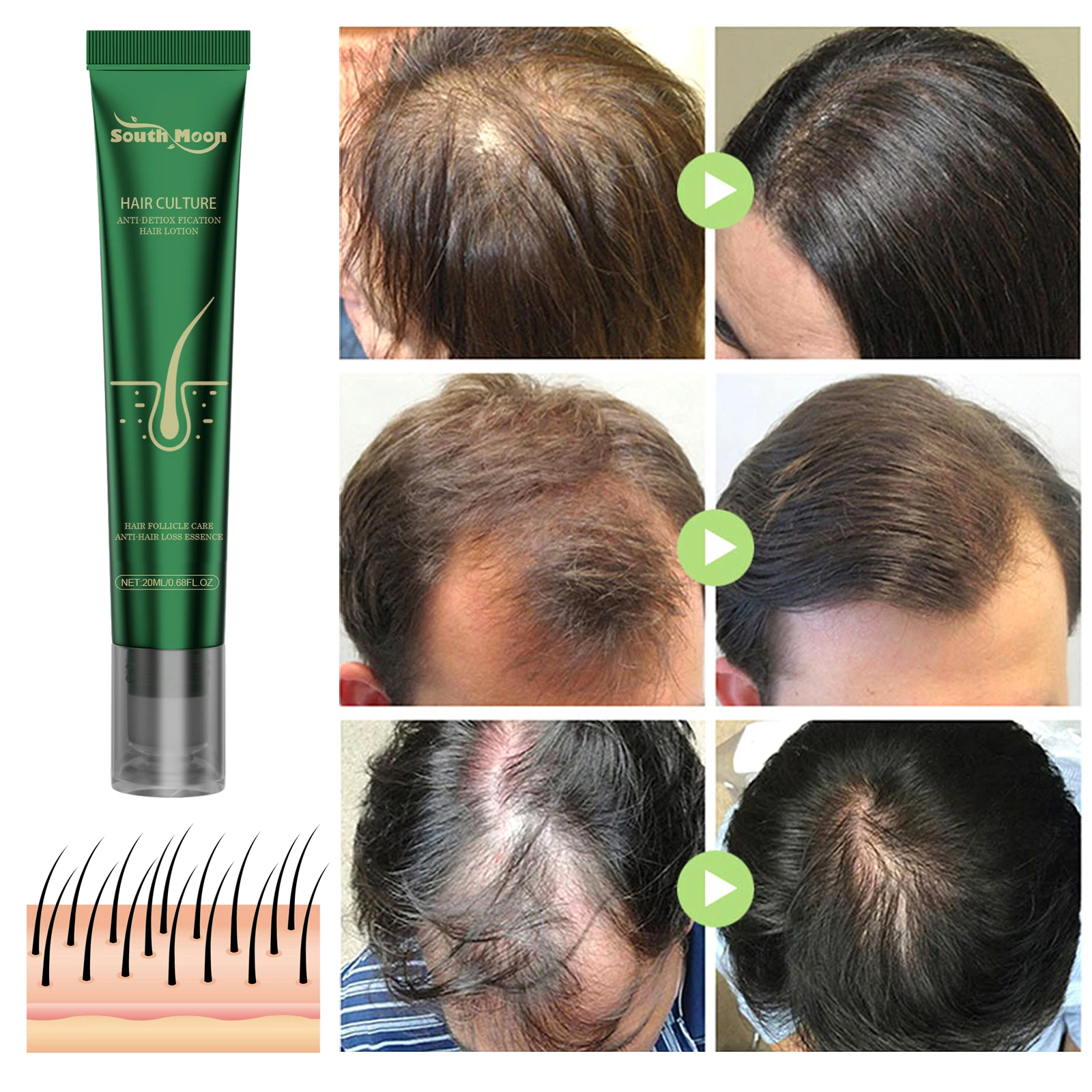 Hair Care Essence Prevent Hair Breakage Reduce Loss Repair Damaged Strengthen Root Ginger Care Essence Lotion hair growth serum hair growth cream hair care oil hair growth spray hair growth shampoo set