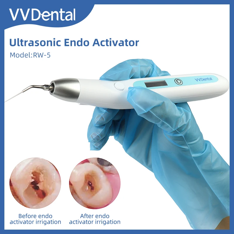 

VVDental Endo Activator Ultrasonic Sonic Irrigator Endodontic With LED for Root Canal Cleaning And Stain Removal Dentistry Tools