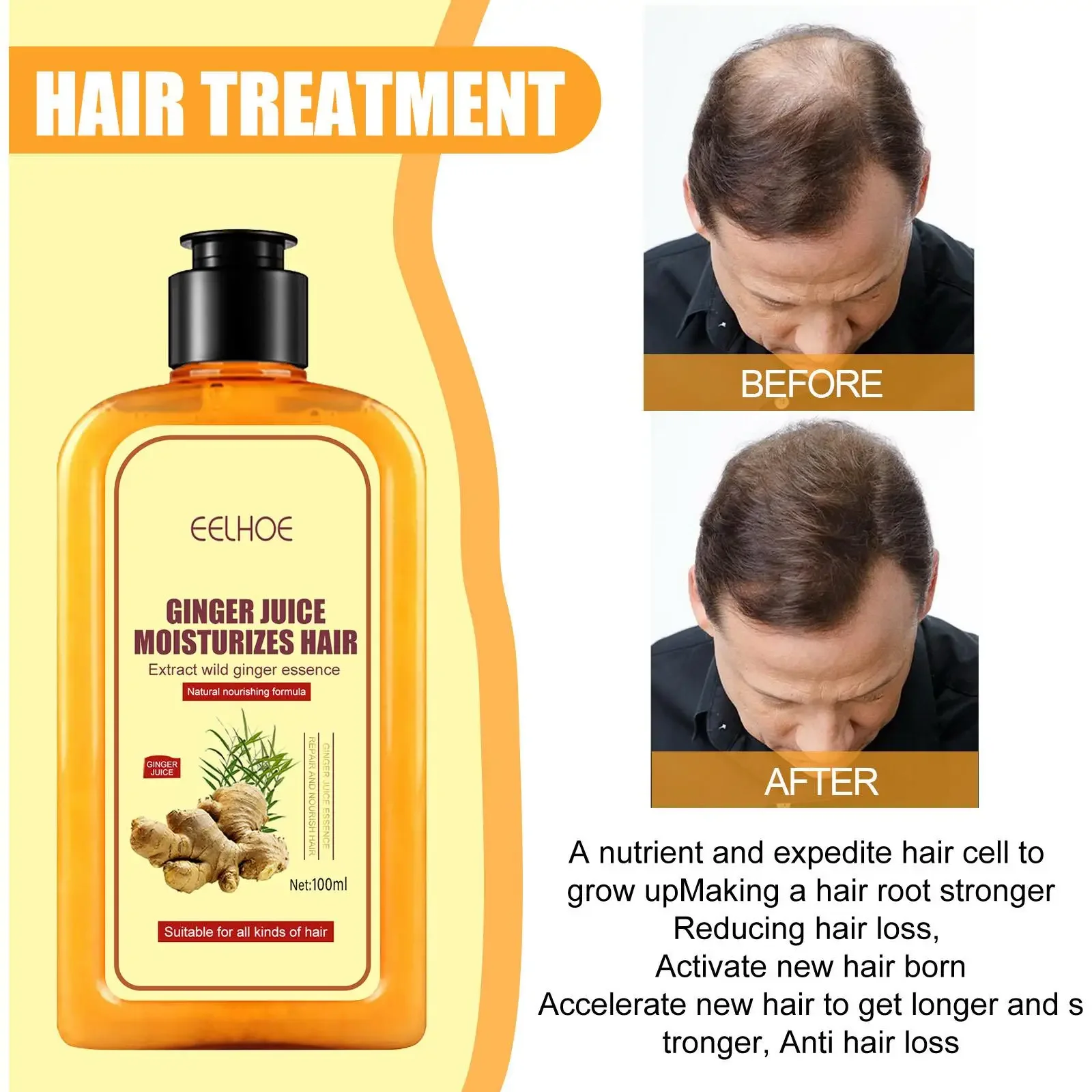 

Ginger Anti Hair Loss Shampoo Шампунь Для Волос Fast Hairs Growing 100ml Herbal Nourishing Hair Roots Repair Damaged 샴푸