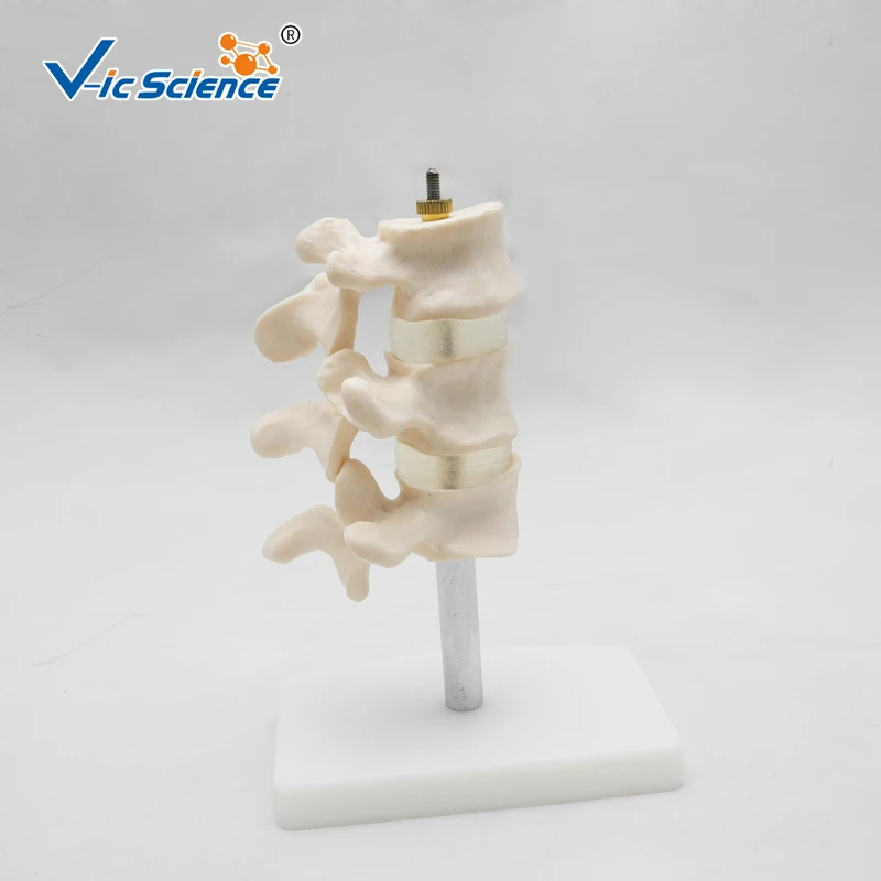 Life Szie Anatomical Human Cutaway Osteoporosis