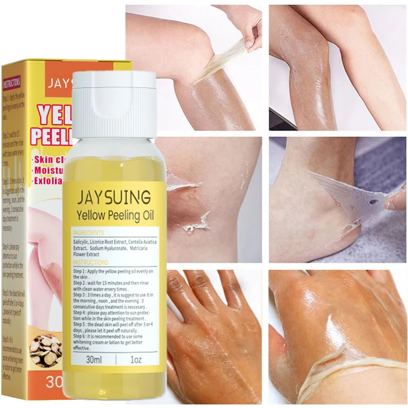 

Yellow Peeling Oil Dark Skin Bleaching Remove Arm Knee Legs Melanin Body Brighten Scrub Exfoliating Dead Skin Care Whiten Serum