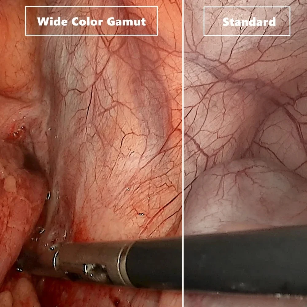 Video Laryngoscope Gastrointestinal Bronchus Endoscopy 360&deg; Rotation Support For IOS Android