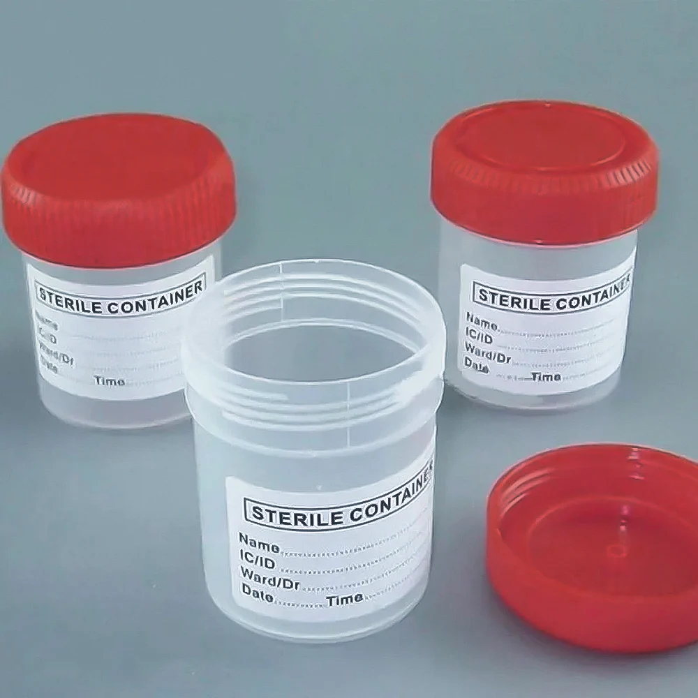 5pcs Urine Collection Sample Cup Specimen Bottle Container 60ML Plastic Cup Container for Use Disposable Urine