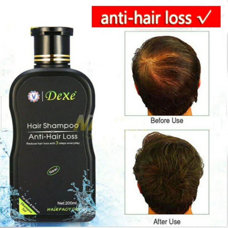 200ml Dexe Hair Shampoo Anti Hair Loss Chinese Herbal Hair Growth Prevent HairLoss Treatment for Men&Women