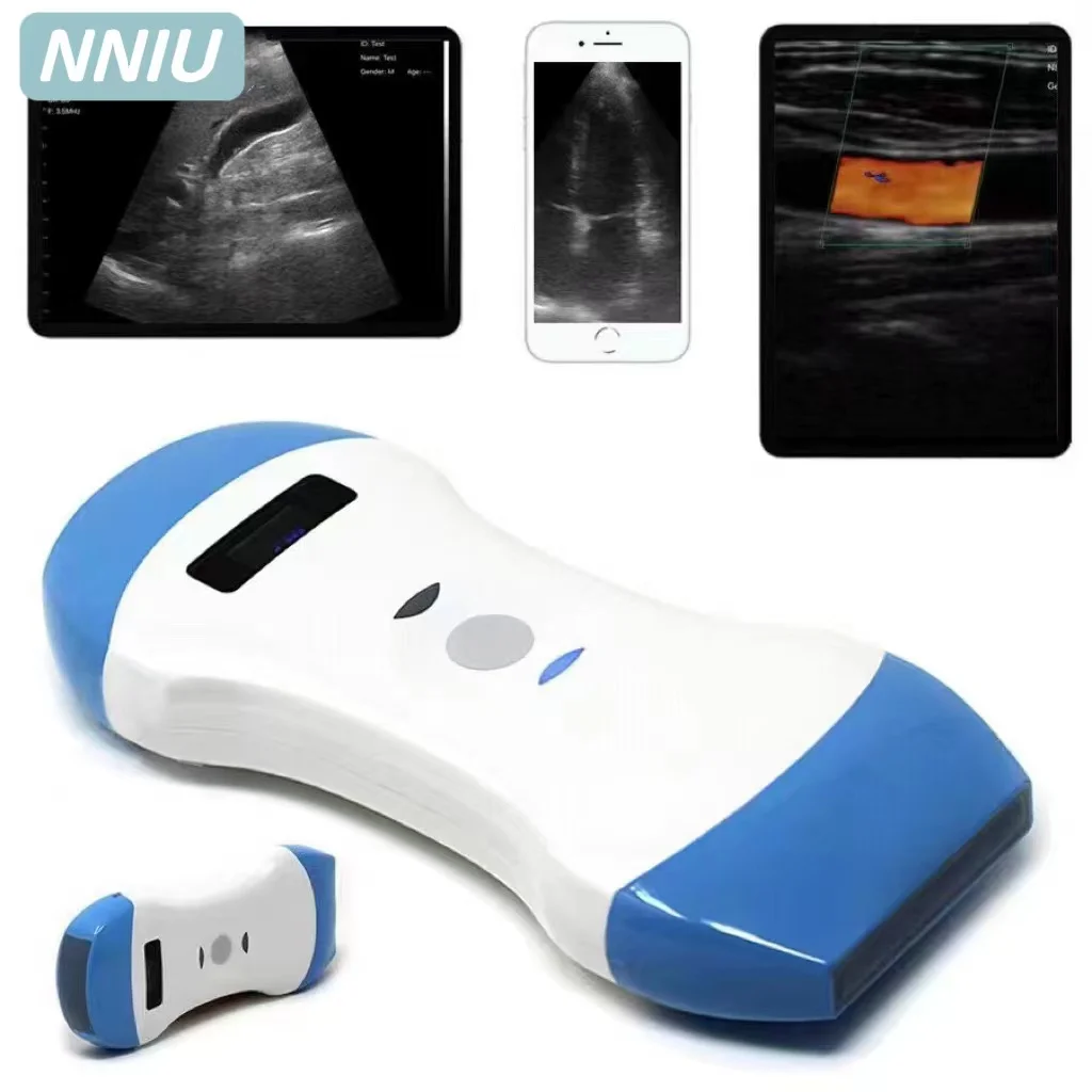 Wireless Ultrasound Probe SCANNER Portable USG WIFI Medical iOS Android Windows APP CE FDA