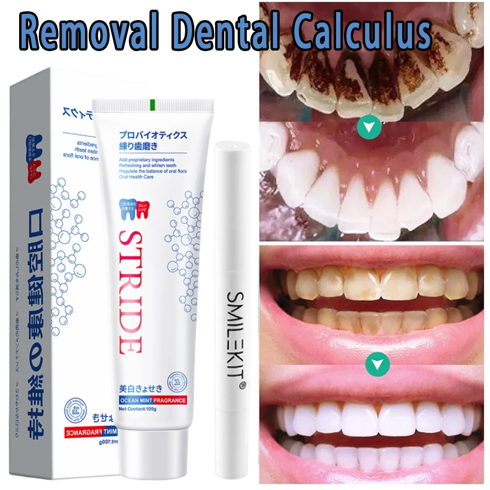 Teeth Whitening Toothpaste Removal Bad Breath Stains Teeth Whitener Preventing Periodontitis Cleaning Product Dental Whitening