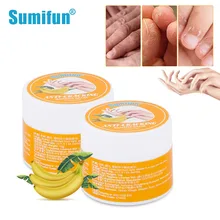 

1/3/5pcs Sumifun 10g/pcs Anti-Crack Banana Blam Cream Repair Dry Cracked Skin Deep Moisturizing Exfoliate Ointment Health Care