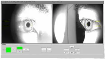 Рисунок 4 - Фотометрия, офтальмологическая