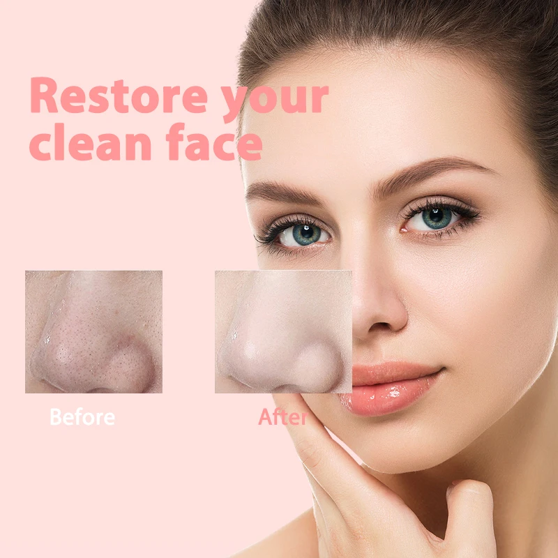 Blackhead Remover Diamond Dermabrasion Nose Vacuum Pore Cleanser Acne Pimple Suction Extractor USB Rechargeable Skin Care Tool 3
