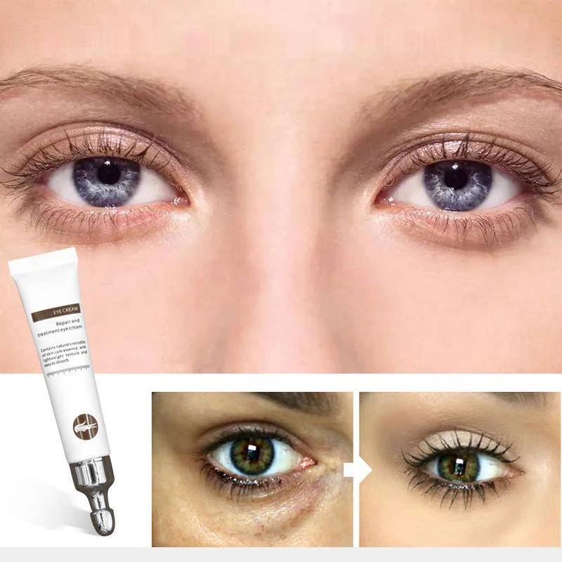 20g Magic Anti-Age Eye Cream Eye Serum Reduce Dark Circles Puffiness Under Bags Wrinkles Care Skin Care Products