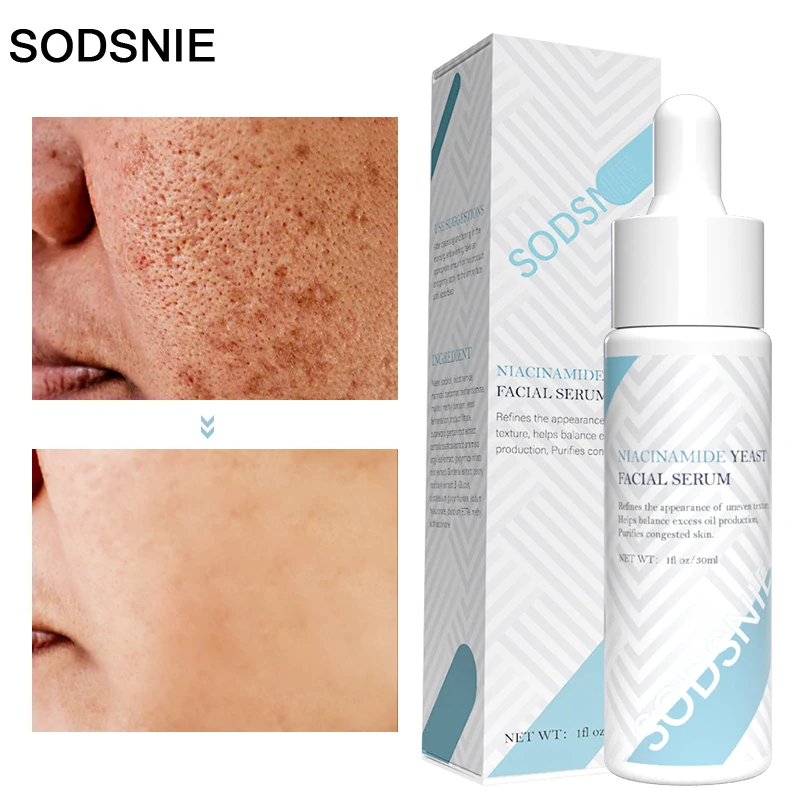 

Face Serum Firming Pores Brighten Skin Whitening Fade Fine Lines Anti-Aging Nourish Skin Mild Valid Wrinkle Nicotinamide 30ml