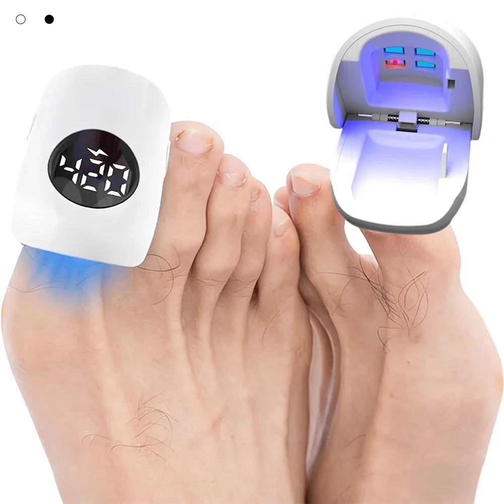 Home Onychomycosis Instrument Portable Nail Fungus Therapy Laser Device Hand And Foot Anti Fungal Tools_voghion.com