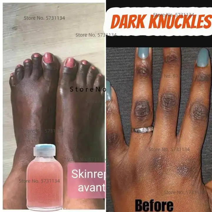Strong Hand and Feet Lightening Whitening Cleasing scrub To Clean Up Dark Knuckles
