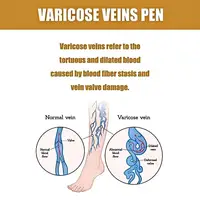 Laser Pen, Protect Your Health. 3