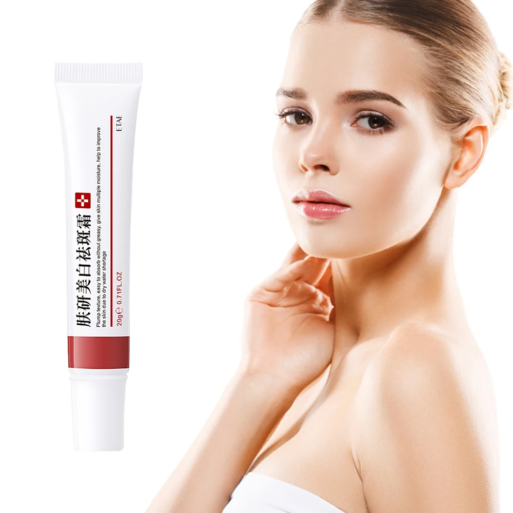 Freckle Whitening Cream Removal Pigment Melanin Correcting Beauty Face Skin Care Nourishing Brighten Fade Dark Spot Corrector 6