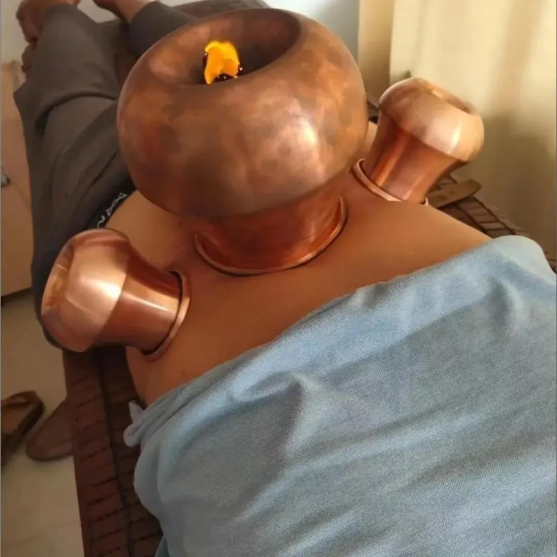 Big Size 13cmX16.5cm Copper Fire Cupping Heating Jars Back Health Care Massage Iastm Gua Sha Soft Tissue Therapy GuaSha Tools 3