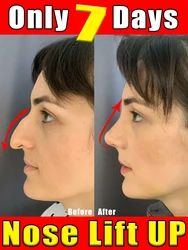 Nose Lift Up Essential Oil Effective Shaping Firming Lifting Nosal Bone Remodeling Massage Natural Essential Oil Nose Care