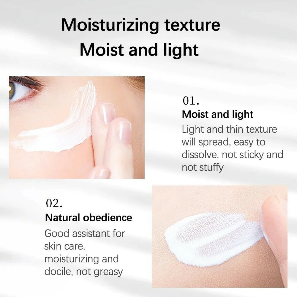 Skin Face Whitening Freckle Cream Remove Melasma Acne Pigment Melanin Dark Spots Anti Freckle Cream Fade Pigmentation Brighten