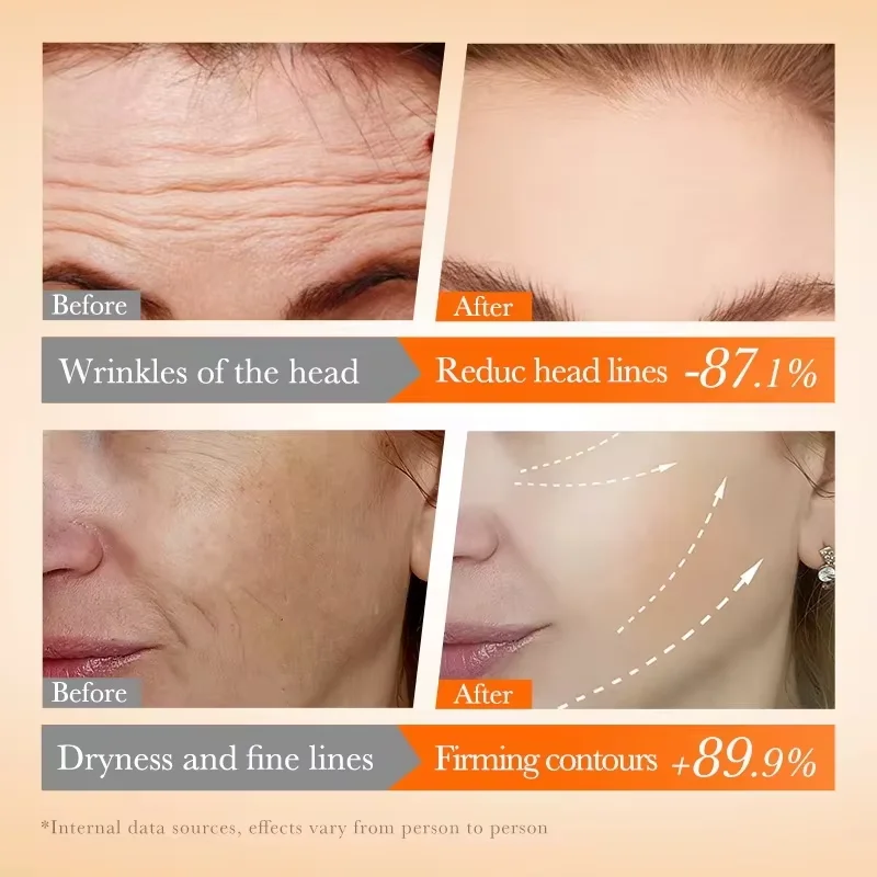 كبسولات حمض الهيالورونيك الوردي مصل مزيل التجاعيد...