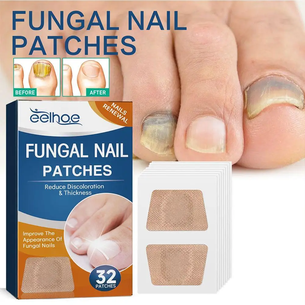 

32pcs/box Paronychia Treatment Patch Fungus Removal Nail Ingrown Correction Stickers Nails Recover Pedicure Tools Health Care