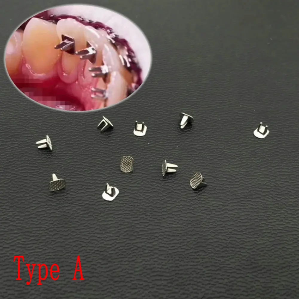 10ps/pack Dental Bite Turbos Orthodontic Tongue Tamer Habbit Correction