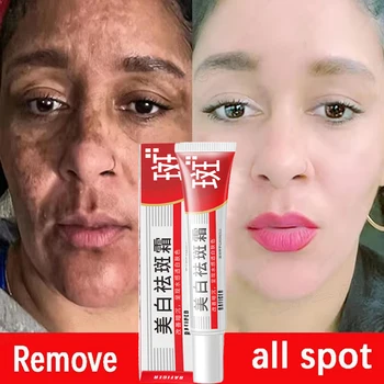 Effective Whitening Freckles Face Cream Remove Melasma Dark Spots Fade Melanin Acne Scars Anti-aging Brighten Repair Skin Care - Thumbnail 3