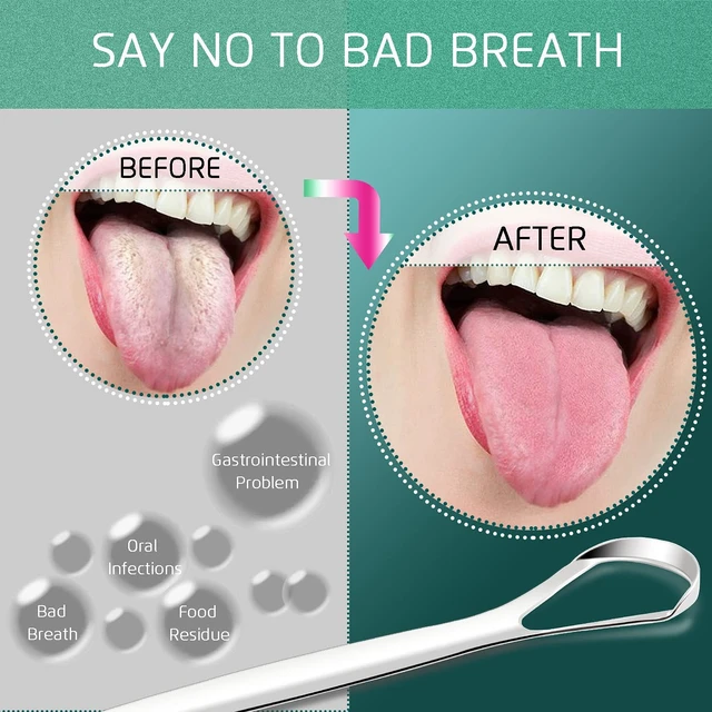 Tongue Scraper for Adults&Kids, Durable Food Grade 2 in 1 Silicone Tongue  Brush and 100% Stainless Steel Tongue Scrapers, Reduce Bad Breath