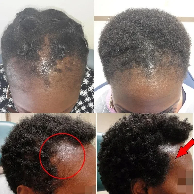 Natural 100% Pure Batana Oil Butter Hair Mask Anti Break Loss Hair Growth From Honduras Loss Treatment for Black Men Women hair mask