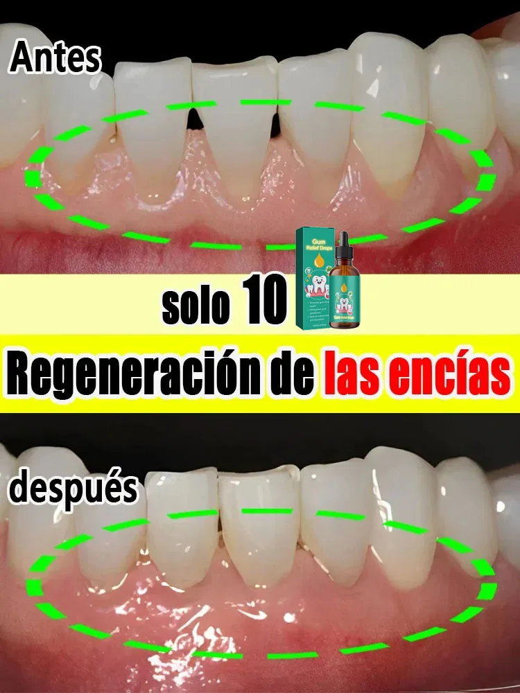Gum Repair Drops Restore gums