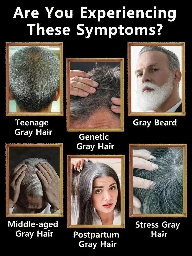 Essenza per capelli anti-grigio Giro bianco Nero Migliora la struttura Rafforza le radici Capelli più spessi e più sani Riduce la salute dei capelli grigi - immagine 4