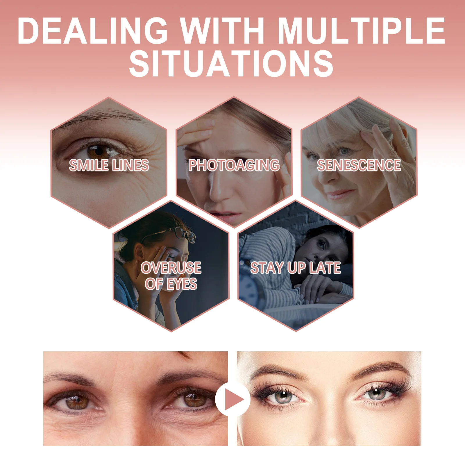 Рисунок 6 - Антивозрастной крем для кожи вокруг глаз