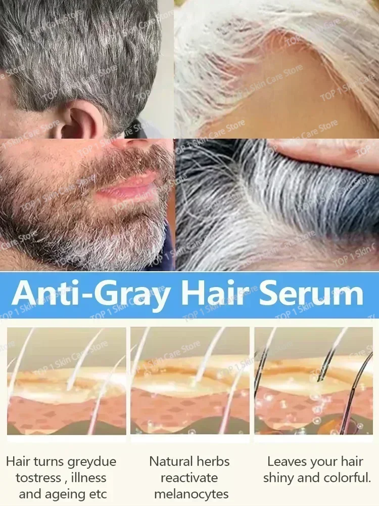 White hair killer, remove gray hair and restore natural color in 7 days