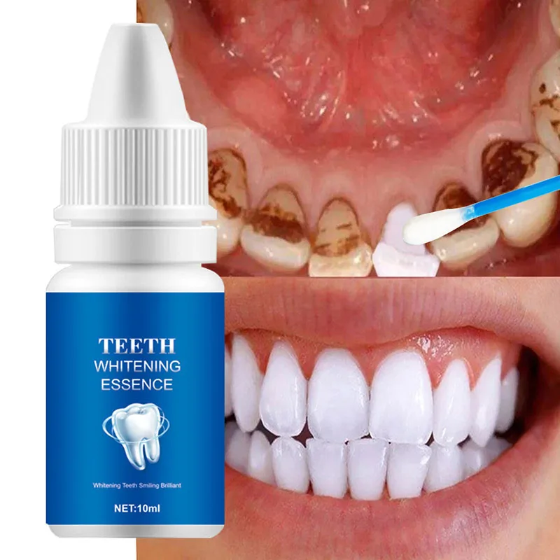 Whitening Tooth Liquid Remove Smoke Stains, Coffee , Tea , Freshen Dad