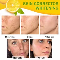 Whitening Cream with Organic Lemon, Dark Spots, Age Spots, Sun Spot Removal Cream, Bleaching Cream, Lightening skin kit