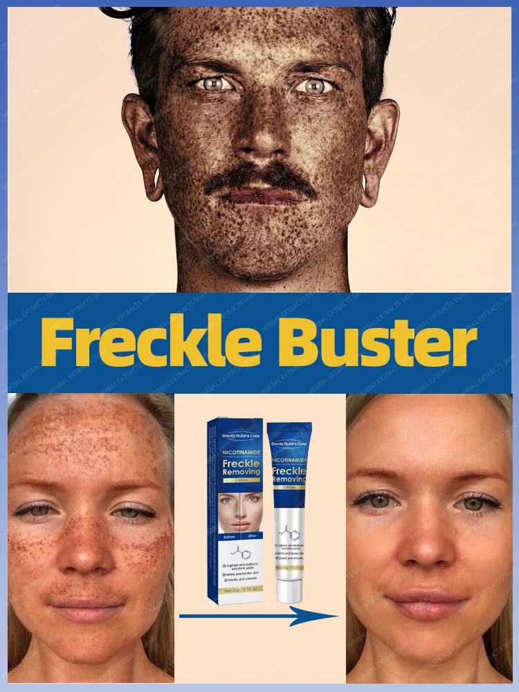 

Freckles Serum Lighten Melanin Improve Dull