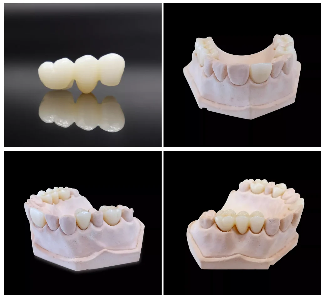 ST Super Translucent Zirconia Cad Cam 98 Open System Dental Lab White Zirconia Ceramic Block