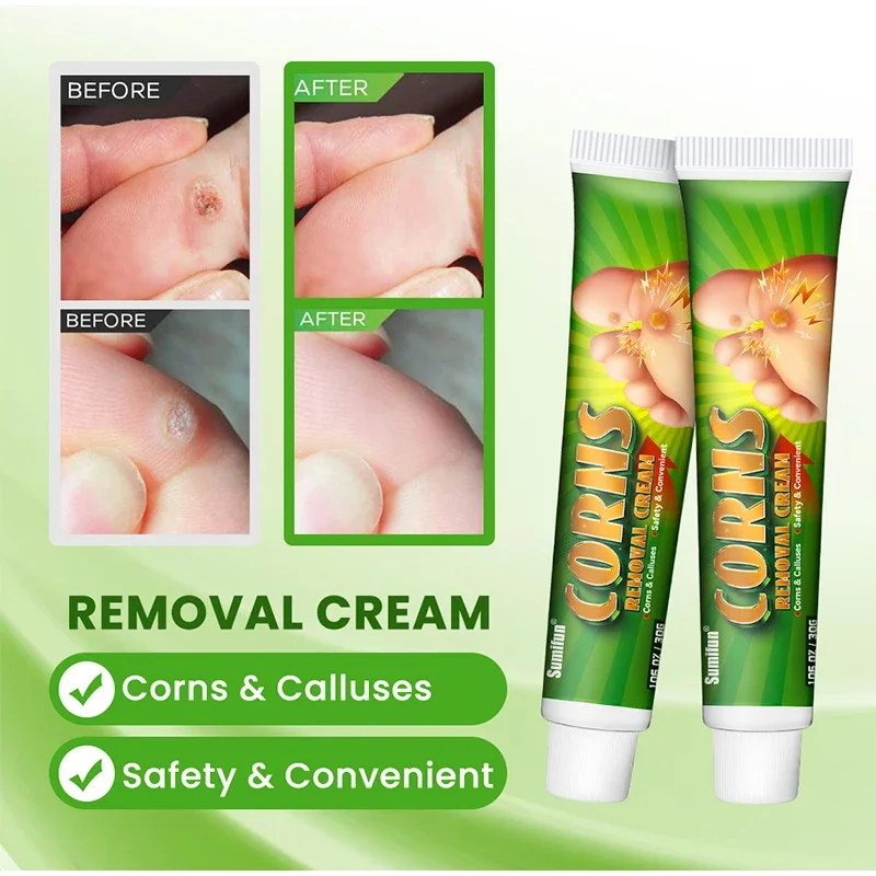 Foot Corn Remover Cream Chicken Eye Skin Infection Treatment Ointment Feet Dead Skin Calluses Removal Tool Health Care new water filters for household bathroom shower filter bathing water treatment health softener chlorine removal water purifier