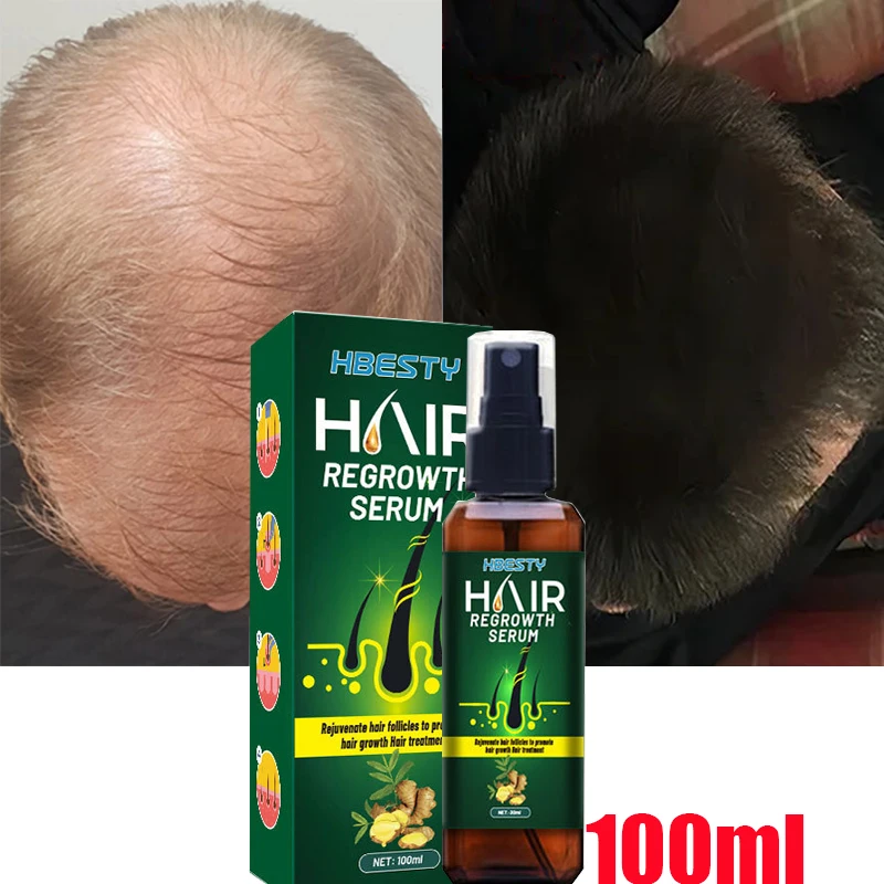 

Fast Hair Growth Spray Products Anti Hair Loss Serum Prevent Baldness Treatment Scalp Dry Damaged Essential Oil Hair Care 100ml