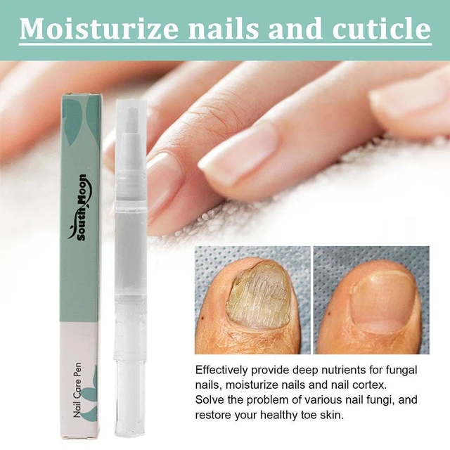 Discover 140+ antifungal for nails best noithatsi.vn