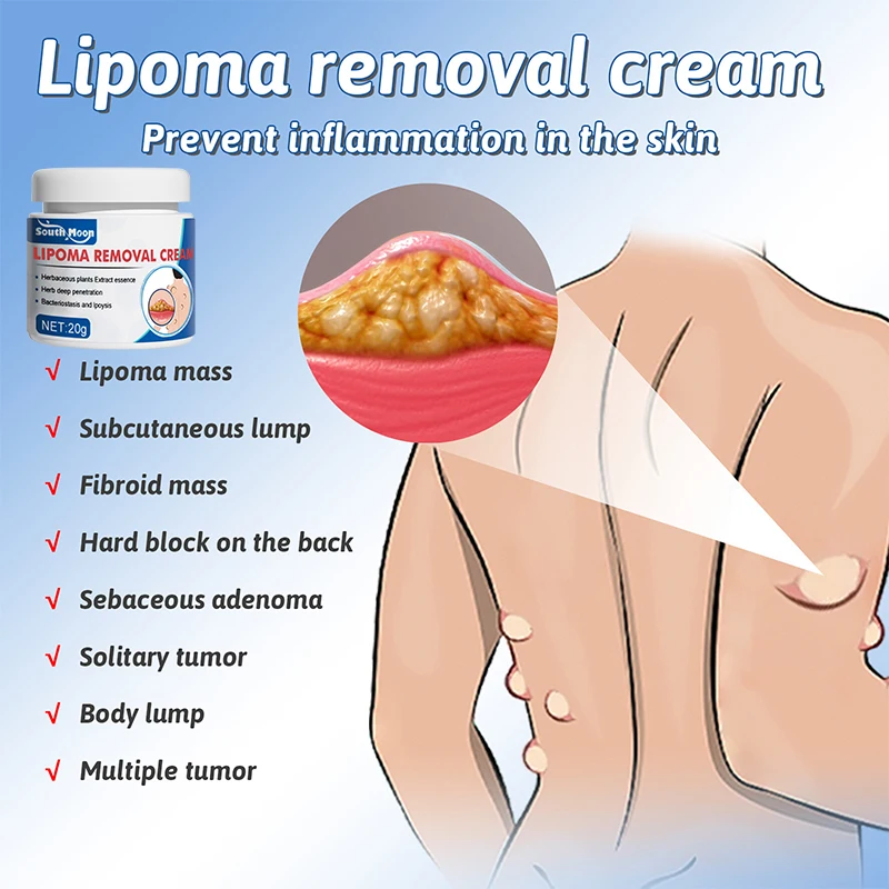 Lipoma Removal Cream 12pcs/20g Antitumor Remove Fat Lump Ointment Nodular Discomfort Skin Cyst Swelling Pain Relief Plaster